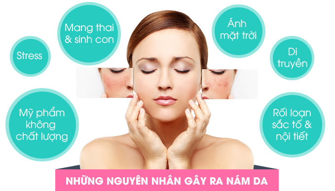 Bị nám da, cứ lấy nắm giá đỗ và củ cải làm thế này sau 2 tuần là sạch bách-1