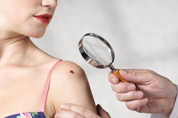 6 lầm tưởng về căn bệnh ung thư dễ mắc nhất khi thời tiết nắng nóng kéo dài-4