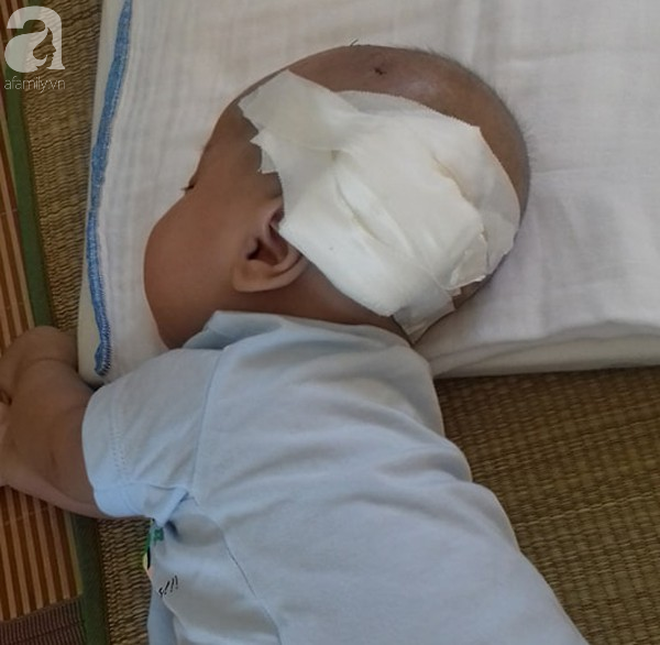 Tiếng khóc xé lòng của bé trai hơn 5 tháng tuổi mắc bệnh não úng thủy-2