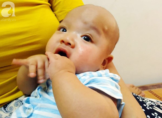 Tiếng khóc xé lòng của bé trai hơn 5 tháng tuổi mắc bệnh não úng thủy-4