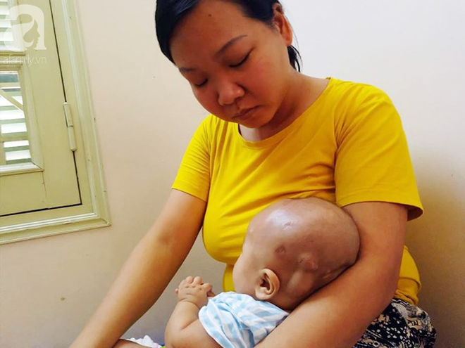 Tiếng khóc xé lòng của bé trai hơn 5 tháng tuổi mắc bệnh não úng thủy-6
