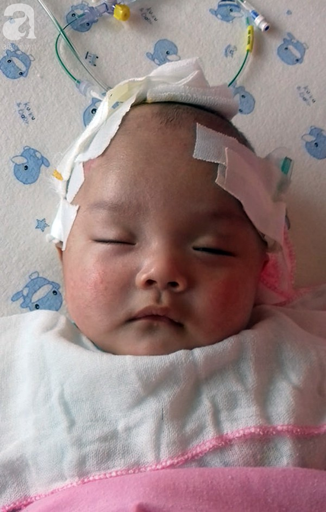 Tiếng khóc xé lòng của bé trai hơn 5 tháng tuổi mắc bệnh não úng thủy-1