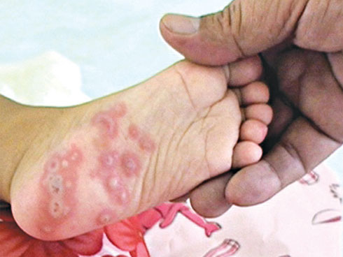 8 nguyên tắc phòng bệnh quan trọng hơn chữa: Ai muốn khỏe cả đời thì nên áp dụng-5