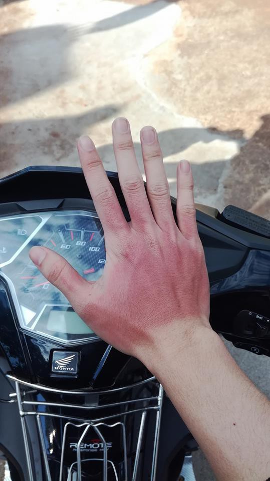 Đặc sản” trong ngày hè nắng nóng khiến nhiều người phải khóc thét-3