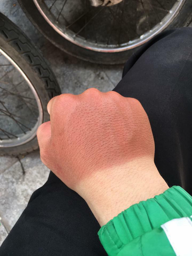 Đặc sản” trong ngày hè nắng nóng khiến nhiều người phải khóc thét-4