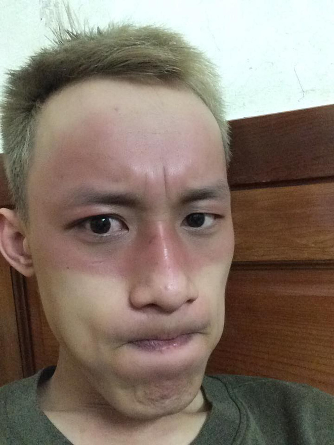 Đặc sản” trong ngày hè nắng nóng khiến nhiều người phải khóc thét-5