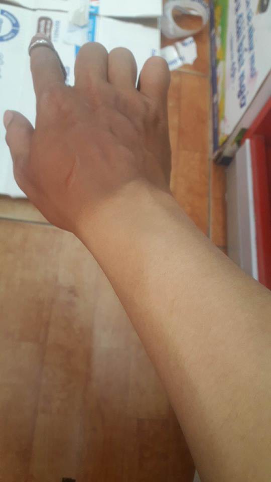 Đặc sản” trong ngày hè nắng nóng khiến nhiều người phải khóc thét-6