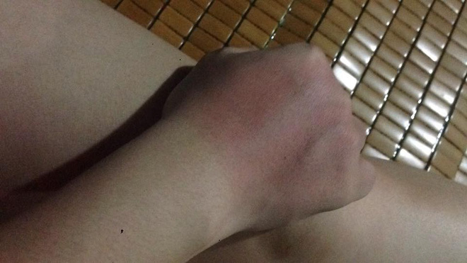 Đặc sản” trong ngày hè nắng nóng khiến nhiều người phải khóc thét-7