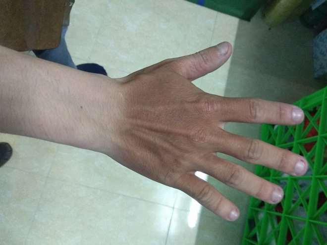 Đặc sản” trong ngày hè nắng nóng khiến nhiều người phải khóc thét-9