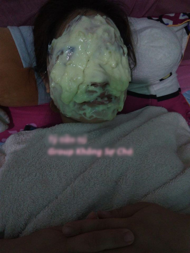 Anh chồng xung phong giúp vợ đắp mặt nạ, kết quả không ngờ-1