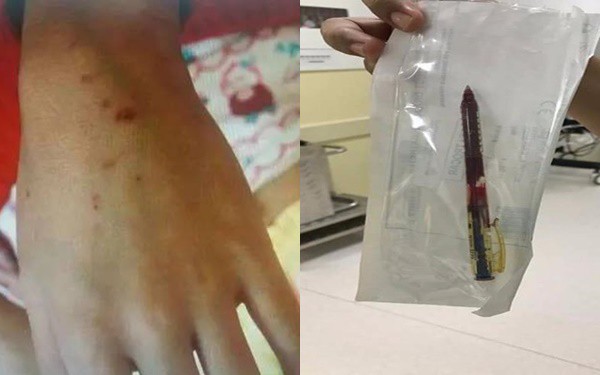 Giáo viên mầm non dùng bút đâm nhiều em nhỏ vì lý do này khiến phụ huynh bức xúc-1