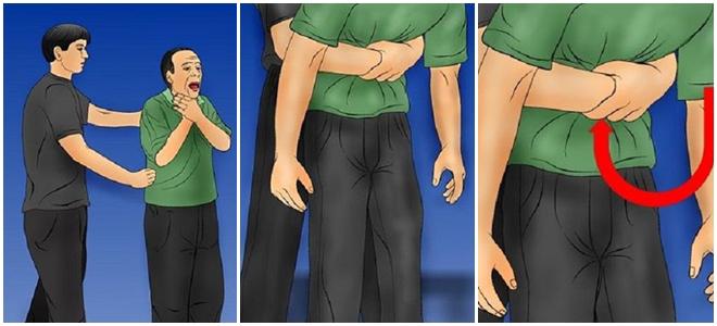 Thực quản bị rách đôi 7cm chỉ vì thói quen chữa nghẹn 90% mọi người đều làm-3