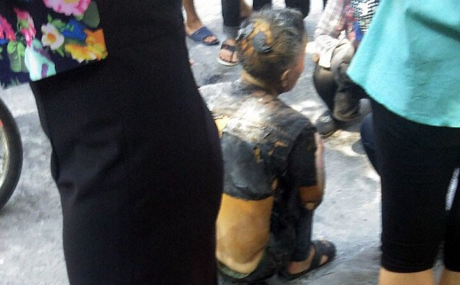 Cụ ông tưới xăng lên người rồi châm lửa tự thiêu giữ phố Hà Nội-1