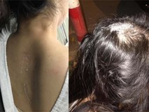 Sự thật thông tin cô gái nghi bị mẹ chồng thuê người đổ keo 502 khắp đầu Sự thật thông tin cô gái nghi bị mẹ chồng thuê người đổ keo 502 khắp đầu