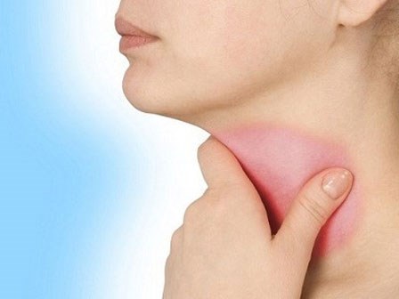 Cảnh báo những thói quen gây viêm họng trong mùa hè ai cũng hay mắc phải