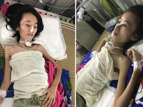 Người mẹ trẻ chỉ còn 20kg cố giành giật sự sống từng ngày để thai nhi 5 tháng tuổi được chào đời