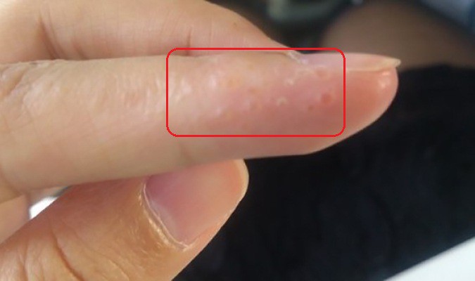 7 dấu hiệu cảnh báo bệnh nguy hiểm biểu hiện trên bàn tay của bạn-2