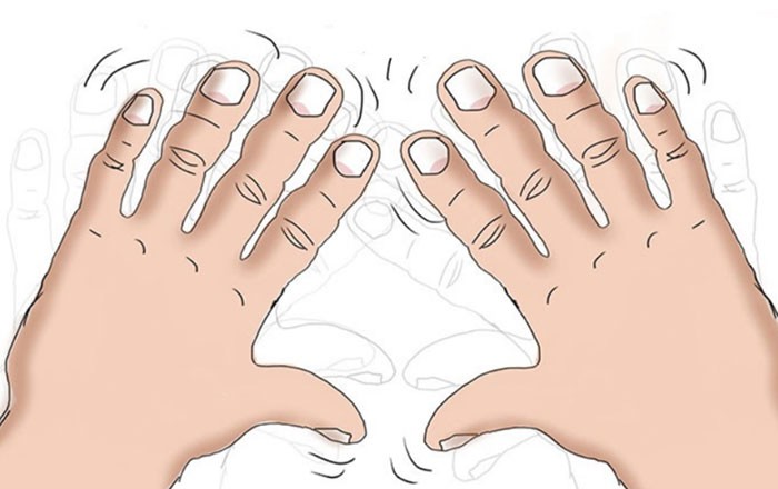 7 dấu hiệu cảnh báo bệnh nguy hiểm biểu hiện trên bàn tay của bạn-6