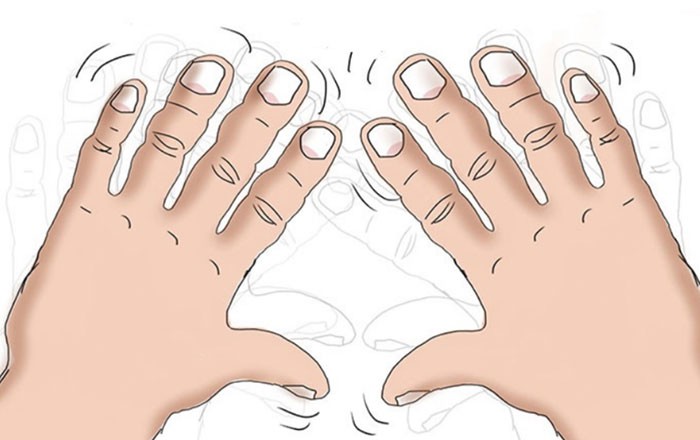 7 dấu hiệu cảnh báo bệnh nguy hiểm biểu hiện trên bàn tay của bạn-6