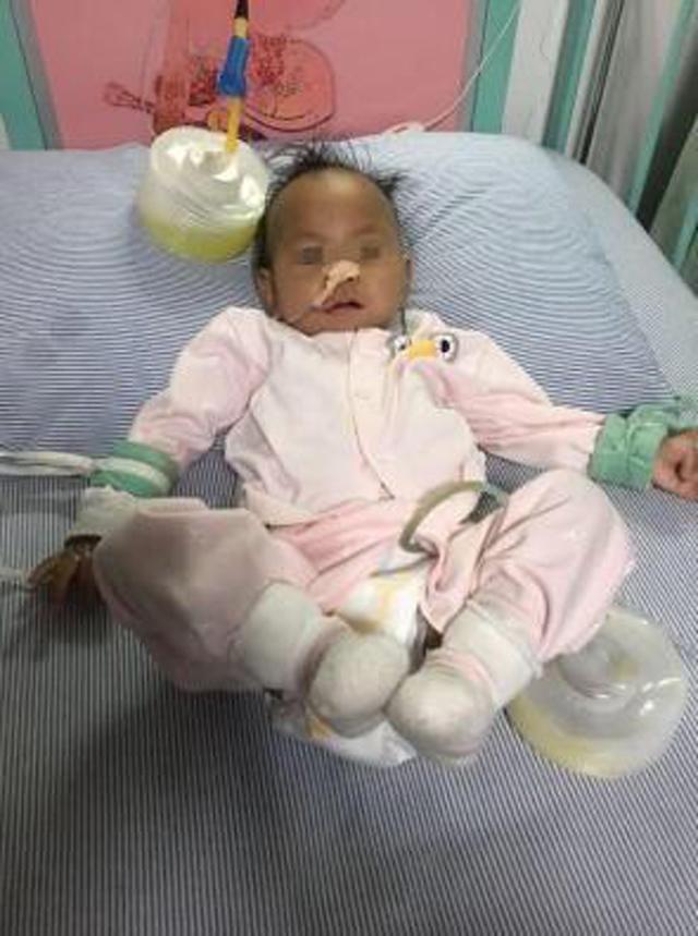 Bé 13 tháng tuổi bục dạ dày vì mẹ cho ăn ngô: 6 người cấm ăn không chỉ trẻ nhỏ-1