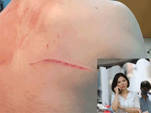 Vợ cũ bác sĩ Chiêm Quốc Thái thừa nhận chủ mưu thuê giang hồ 'xử lý' chồng