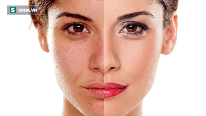 Khi 4 bộ phận cơ thể chuyển màu đen: Hãy thận trọng với dấu hiệu bệnh gan đang phát triển-1