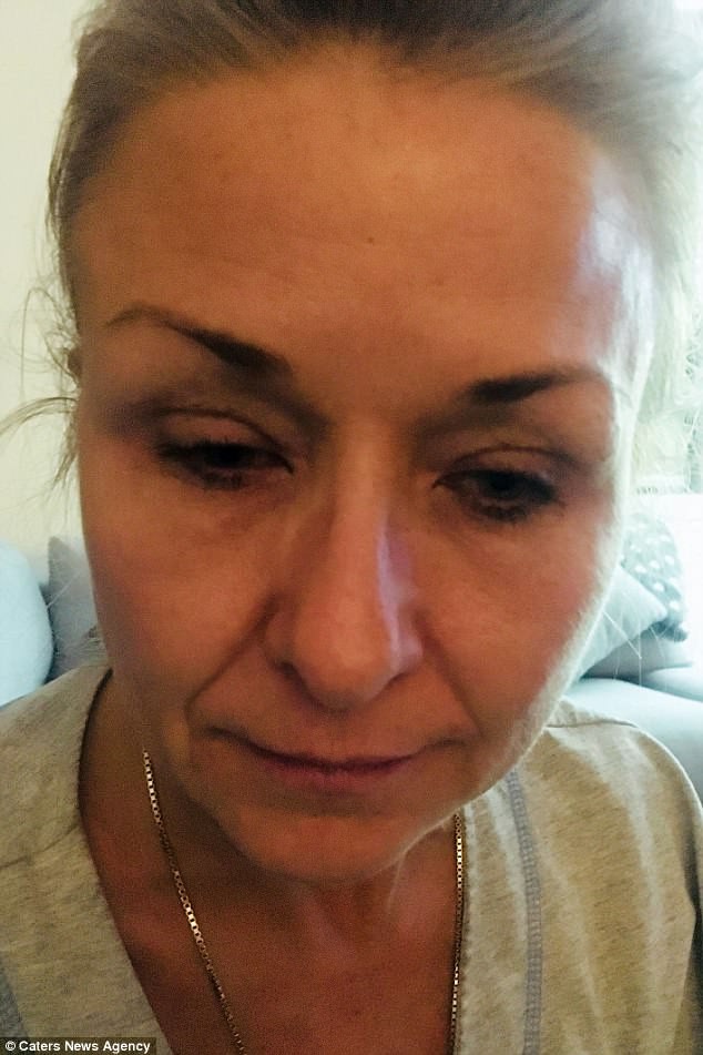 Chuốt mascara 25 năm không tẩy trang, người phụ nữ phải trả giá đắt cho sự lười biếng của mình-1