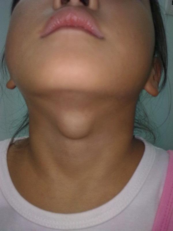 90% người dân ăn mặn, nhưng Việt Nam vẫn thuộc top thiếu i-ốt nhất thế giới vì thói quen này-3