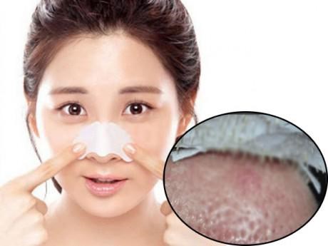 Các nàng sẽ dừng ngay việc dùng miếng dán lột mụn nếu biết những sự thật kinh khủng sau