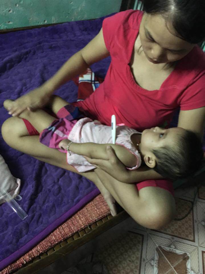 Tưởng chỉ ốm sốt thường, mẹ ngỡ ngàng sau 1 tháng đi viện, con về với thân hình co quắp-2