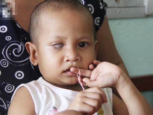 Bé gái 3 tuổi bị ung thư mắt, bố mẹ chở phân bò dành dụm từng đồng tìm lại ánh sáng cho con trong vô vọng