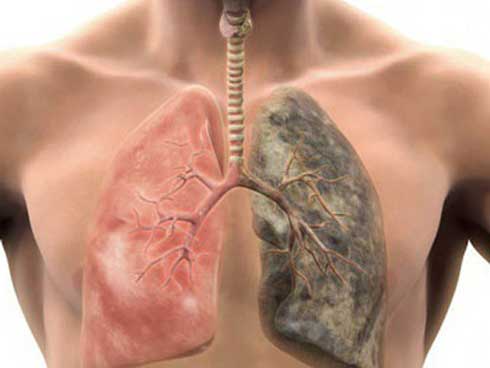 Có 3 biểu hiện sau khi ngủ chứng tỏ phổi bị tổn thương, tránh xa 3 loại khói” sẽ giúp phổi khỏe mạnh-4