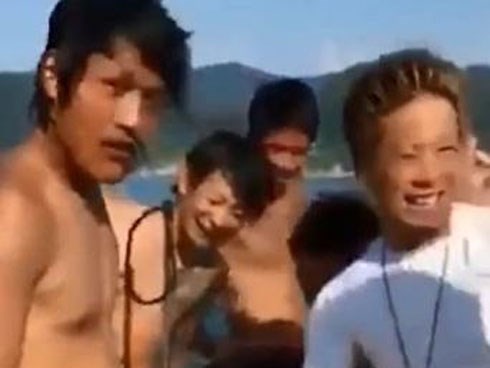 Chàng trai bị cá ngoạm chặt “của quý