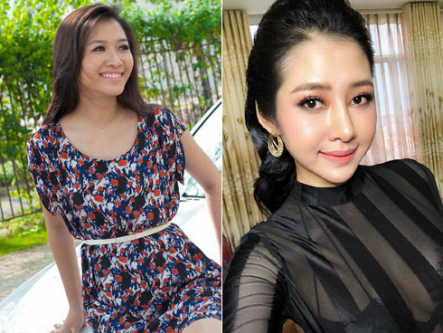 Khoe chồng rút 100 triệu cho mình đi nâng mũi, sửa ngực dù cả hai đang ở trọ, cô vợ khiến hội chị em dậy sóng-3