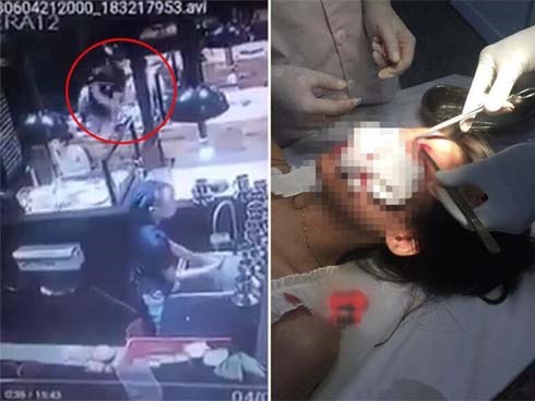 Hai cô gái bị nam thanh niên ném cốc, đánh túi bụi ở quán ăn