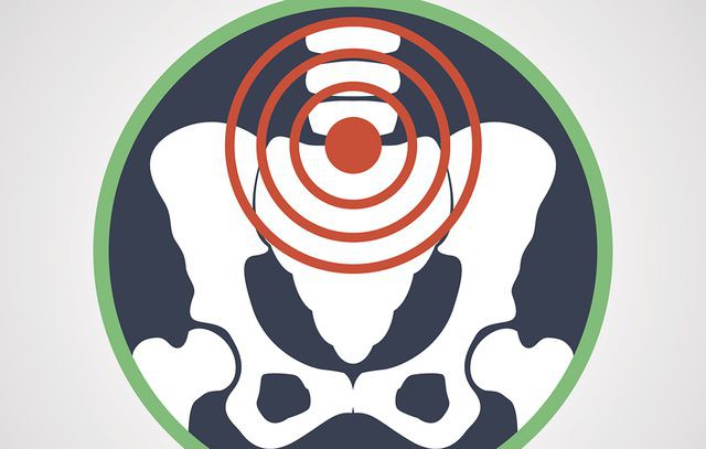 6 dấu hiệu cảnh báo bệnh ung thư cổ tử cung: Mọi phụ nữ đều nên biết để phòng ngừa sớm-2