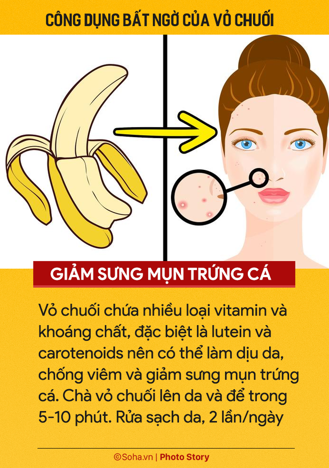 Ăn chuối hàng ngày nhưng ít người biết 7 công dụng từ vỏ chuối: Nhớ đừng vứt vào thùng rác-1