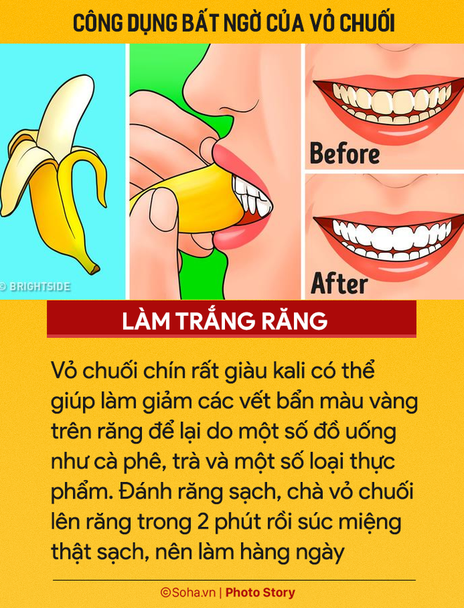 Ăn chuối hàng ngày nhưng ít người biết 7 công dụng từ vỏ chuối: Nhớ đừng vứt vào thùng rác-4