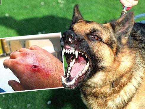 Mắc bệnh dại tử vong 100%, 4 bước cần làm ngay khi bị chó cắn-2