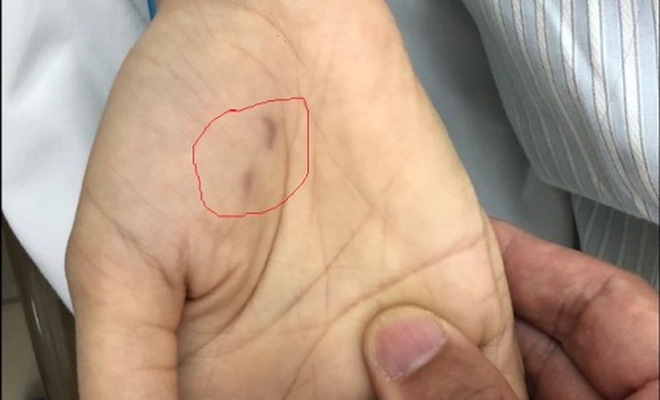 Đến bác sĩ thú y cũng chết vì bệnh dại: VN bị coi là điểm nóng toàn cầu bởi con số đáng sợ-1