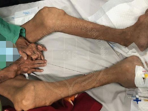 Tự uống thuốc giảm đau tại nhà, cô gái 25 tuổi tử vong đau đớn-4