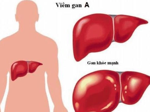 Chết vì nhiễm viêm gan A do ăn lựu đông lạnh: cảnh giác loạt bệnh dễ lây qua ăn uống