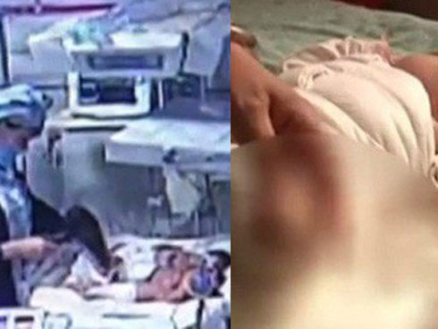 Bị lọ nước hoa rơi trúng chân, người phụ nữ chịu đựng nỗi đau suốt 2 năm trước khi buộc phải cắt bỏ một phần chân-5