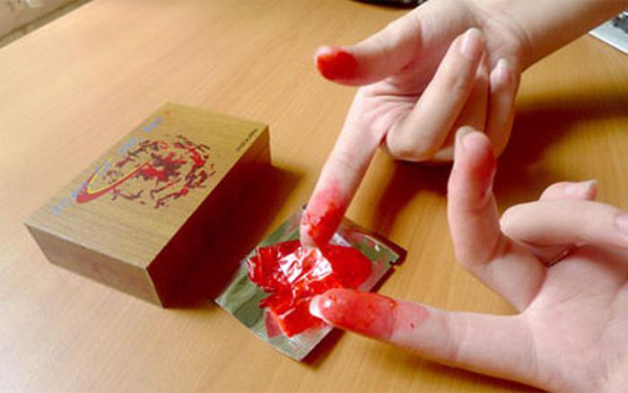 Vá cái ngàn vàng”: Mất rồi, lại... mất thêm!-2