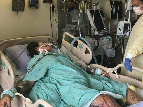 Suýt chết vì nhiễm virus ăn thịt người từ chiếc đinh gỉ sét