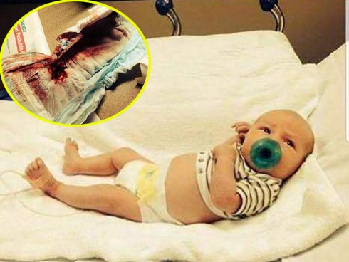 Đưa con sơ sinh đi cắt bao quy đầu, mẹ bàng hoàng khi thấy máu chảy không ngừng