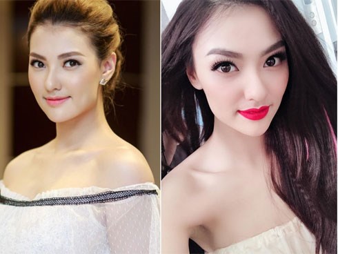 Hồng Quế nói gì trước nghi vấn gương mặt nhọn bất thường vì dao kéo?