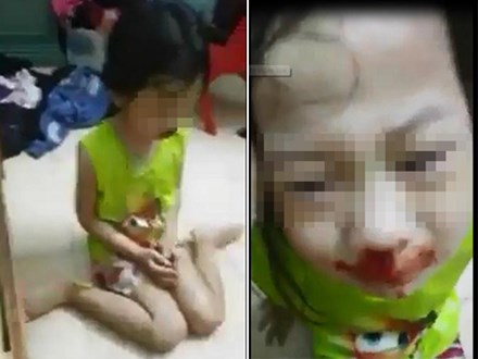 Nghi vấn mẹ đánh con gái chảy máu mũi rồi livestream gây phẫn nộ cộng đồng mạng