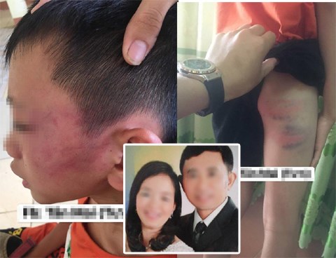 Lời trần tình của cô giáo là mẹ kế bị tố 