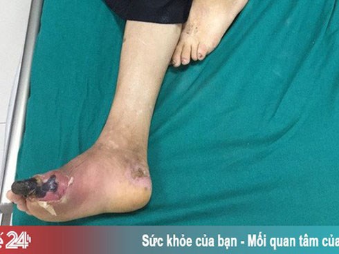 Đái tháo đường -